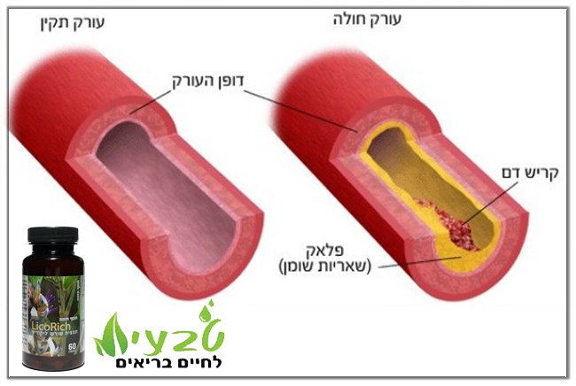 Read more about the article שלא יעבדו עליכם!